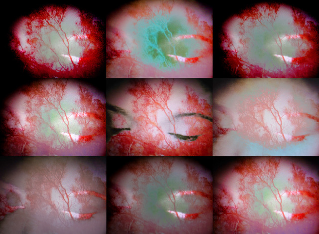 9 square images of closed eyes with trees overlaid on the image in different exposures of red, green, and white. Credit: Tama Hochbaum